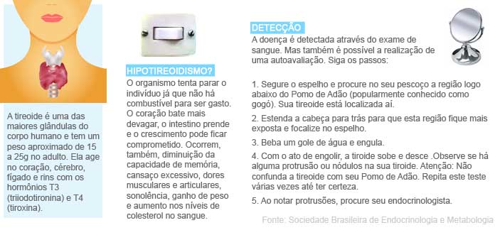 Infografia: Canal I�ara